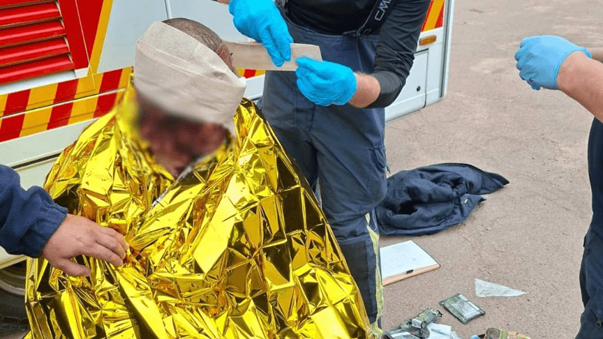 Лікарі надають першу необхідну медичну допомогу постраждалому внаслідок російської атаки на Житомирщині, 30 липня 2026 року
