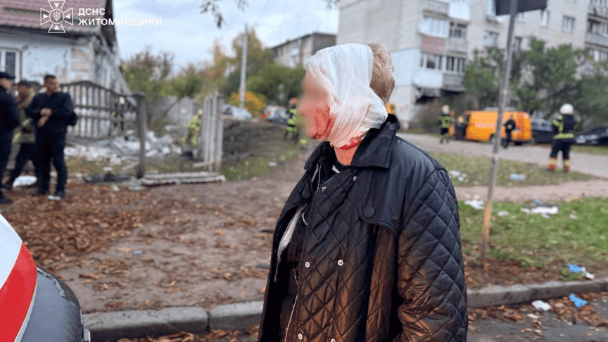 Жінка, поранена внаслідок російської атаки по Житомирщині, 22 жовтня 2026 року