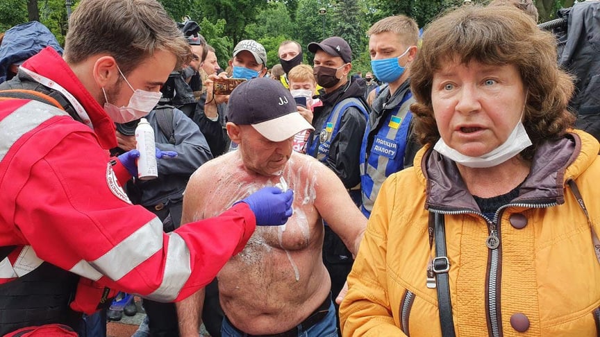 Чоловік підпалив себе на акції проти Авакова під Верховною Радою, 5 червня 2020 року