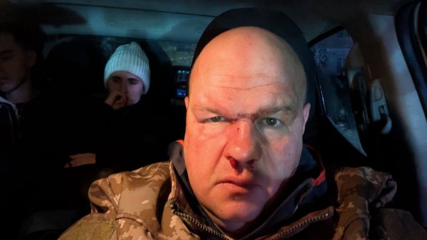 Військовий після бійки в Кременці