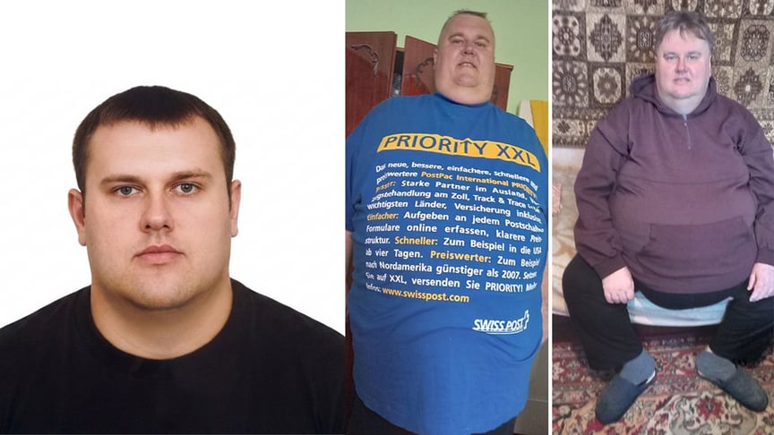 Андрій Стесюк до хвороби (фото ліворуч) і під час хвороби Андрій Стесюк до хвороби (фото ліворуч) і під час хвороби