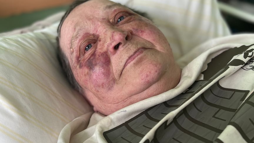 75-летняя Татьяна Антонюк в больнице Святого Луки