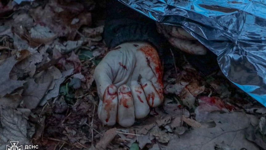 Загибла людина унаслідок російської атаки на Вінниччині